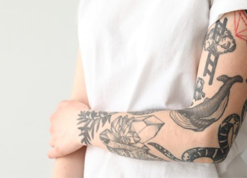 Tattoo removal for all pigment tattoos