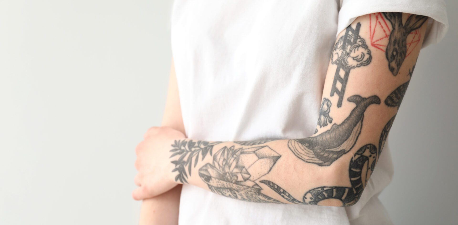Tattoo Removal